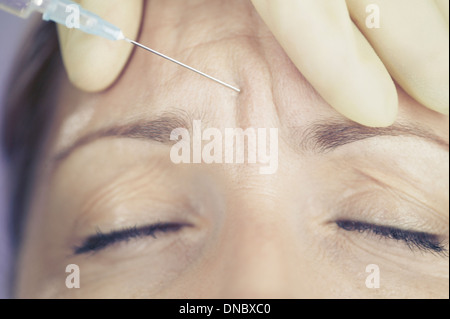 Una donna di mezza età avente una iniezione di Botox nella sua fronte Foto Stock