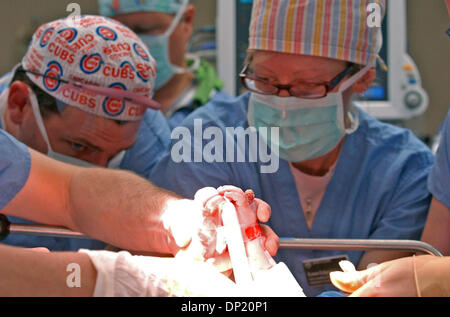 Maggio 12, 2006; Rochester, MN, Stati Uniti d'America; studentessa infermiera anesthesist KAREN ECKERMAN lavora per prep gemelli siamesi Abbigail e Isabelle Carlsen a 9:15 am venerdì. Credito: Foto di Joey McLeister/Minneapolis Star T/ZUMA premere. (©) Copyright 2006 by Minneapolis Star T Foto Stock