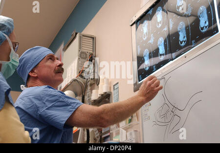 Maggio 12, 2006; Rochester, MN, Stati Uniti d'America; piombo chirurgo Dr. Christopher moiré e il dottor JANE MATSUMOTO rivedere le immagini dei gemelli durante un intervento chirurgico di credito obbligatorio: Foto di Joey McLeister/Minneapolis Star T/ZUMA premere. (©) Copyright 2006 by Minneapolis Star T Foto Stock