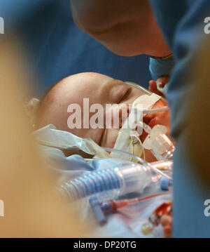 Maggio 12, 2006; Rochester, MN, Stati Uniti d'America; Belle Carlsen è rimasto nel principale teatro chirurgico dopo la sua sorella, Abby, è stata presa per pazienti pediatrici ICU dopo una separazione di successo chirurgia presso la Mayo Clinic. Belle è rimasto dietro perché aveva bisogno di ulteriore terapia cardiaca. Credito: Foto di Joey McLeister/ZUMA premere. (©) Copyright 2006 by Minneapolis Star T Foto Stock