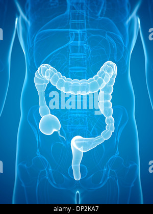 Gli spasmi del colon, artwork Foto Stock