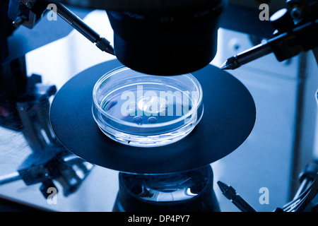 Trattamento di fecondazione in vitro Foto Stock