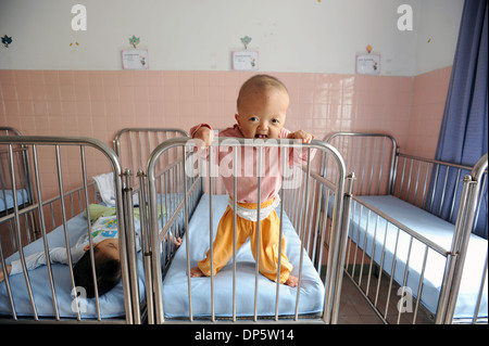 Un infante con mani deformata nel villaggio della pace ward di Tu Du Hospital di Ho Chi Minh City. Foto Stock