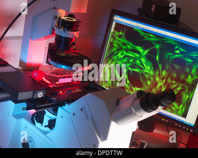 Microscopio invertito la visualizzazione di cellule staminali nel pallone con visualizzazione di un fluorescente cellule marcate Foto Stock