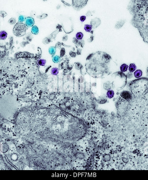 Il tem di virus di immunodeficienza umana (HIV) virion Foto Stock