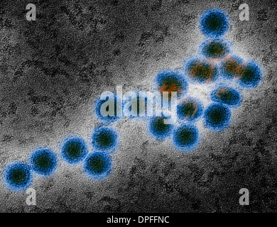 EM del virus del Nilo occidentale Foto Stock