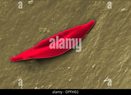 SEM di una cella di falce di cellule di sangue rosso Foto Stock