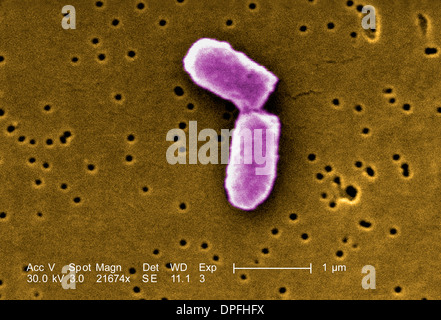 SEM della divisione di Escherichia coli batterio Foto Stock