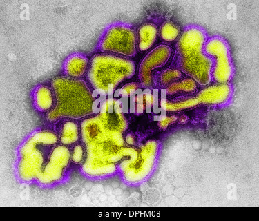 Il tem di A/New Jersey/76 (HSW1N1) influenza suina virus Foto Stock