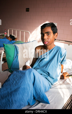 Giovani rurale ragazzo indiano brucia paziente del Sathya Sai Super Speciality hospital. Puttaparthi, Andhra Pradesh, India Foto Stock