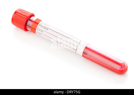 Fiala di campione di sangue con il campione di sangue su sfondo bianco Foto Stock