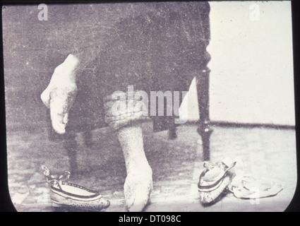 Donna cinese legato i piedi, Changde, Hunan, Cina, ca.1900-1919 (IMP-YDS-RG008-358- Foto Stock