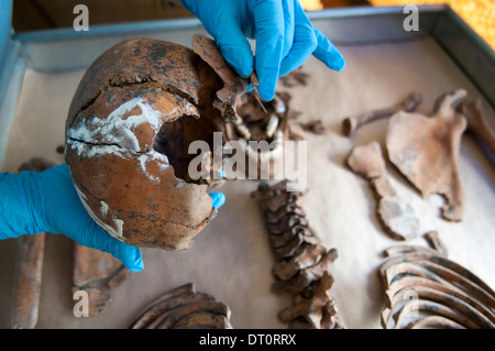 Archeologo forense esaminando un teschio umano alla camera mortuaria facility di ICMP commissione delle persone scomparse in Lukavac, Bosnia Foto Stock