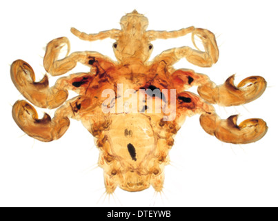 Pthirus pube, pidocchio di granchio Foto Stock