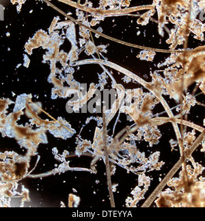 Trichinella spiralis, nematode parassita Foto Stock