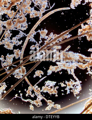 Trichinella spiralis, nematode parassita Foto Stock