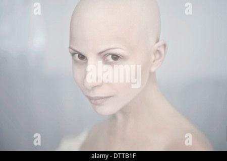 La donna caucasica con testa calva Foto Stock