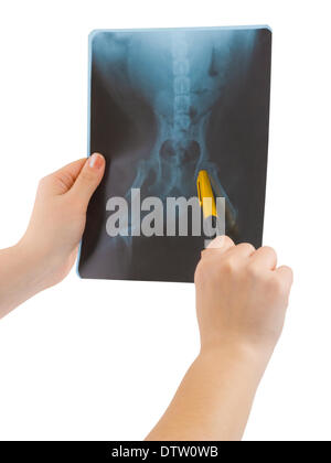 Nelle mani di raggi x Foto Stock