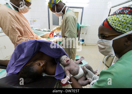 C-sezione nell'ospedale di MSF ,Rutshuru,Nord Kiwu ,RDC,Repubblica Democratica del Congo. Foto Stock