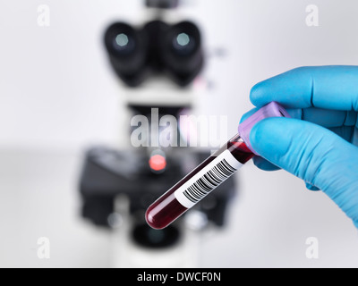 Laboratorio di uno scienziato tenendo un campione di sangue con un montante microscopio composto in background Foto Stock