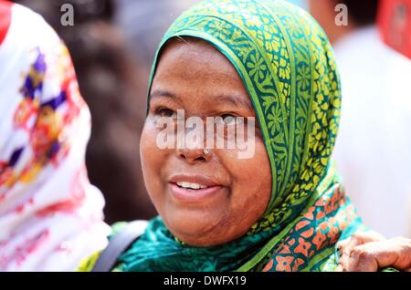 Dacca in Bangladesh. 06 Mar, 2014. I superstiti degli attacchi di acido, partecipare a una catena umana per protestare contro la violenza di acido alla vigilia della Giornata internazionale della donna la celebrazione a Dhaka, nel Bangladesh, 07 marzo 2014. Secondo i sopravvissuti di acido Foundation (ASF), vi era stato un acido 3,184 attacchi sin dal febbraio 1999 al febbraio 2014 in Bangladesh, dove 1.792 donne sono state vittime tra un totale di 3,512. Foto Stock