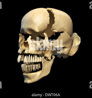 Cranio umano con parti esplose. In prospettiva, su sfondo nero. Percorso di clipping incluso. Foto Stock