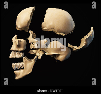 Cranio umano con parti esplose. Vista laterale, su sfondo nero. Percorso di clipping incluso. Foto Stock