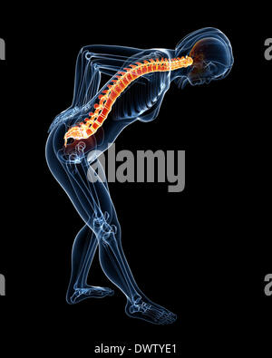 Dolore alla schiena donna disegno Foto Stock
