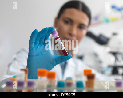 Medico preparando per visualizzare il campione di sangue al microscopio in laboratorio per analisi cliniche Foto Stock