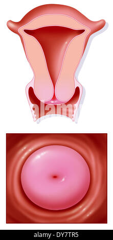 Cervice uterina, disegno Foto Stock