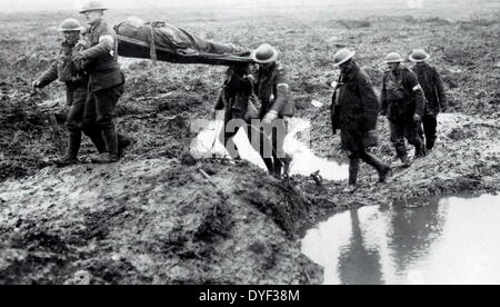 I canadesi hanno ferito nella battaglia di Passchendaele. Questa fotografia mostra un soldato canadese essendo portato da Stetcher-Bearers attraverso la shell di fori per i feriti aiuto post. Sconosciuto Foto Stock