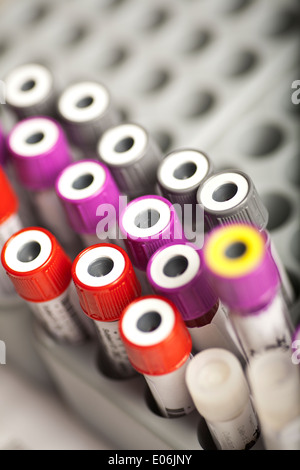 Campione di sangue in campioni di laboratorio il vassoio Foto Stock
