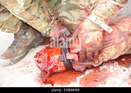 Combattimento militare applicazione Tourniquet C-A-T bean utilizzato dalla British Army medics su un esercizio di formazione prima di bean distribuito Foto Stock