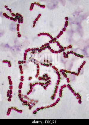 Streptococcus pyogenes Foto Stock