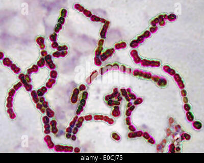 Streptococcus pyogenes Foto Stock