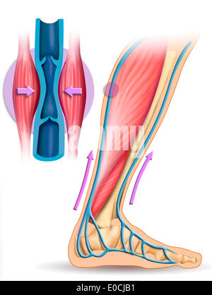 Insufficienza venosa Foto Stock