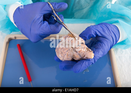 Patologo in un laboratorio apertura di un campione di tessuto di test e analisi, close up mani con guanti e il tessuto Foto Stock