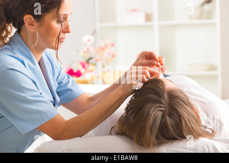 Terapista di agopuntura applicando aghi di agopuntura per la sua testa della cliente Foto Stock