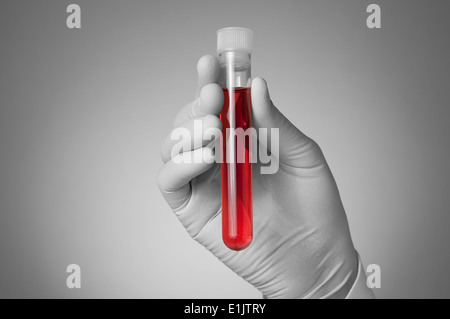 Medico tenendo una bottiglia di campione di sangue Foto Stock