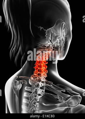 Femmina della colonna vertebrale cervicale computer grafica. Foto Stock