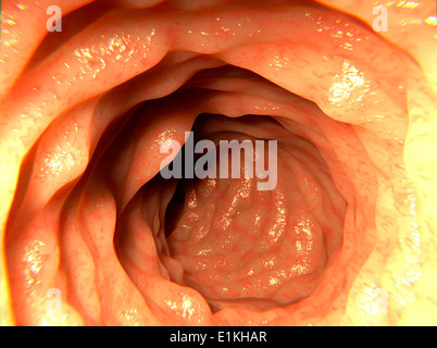 Opera sulla base di un'immagine endoscopica di un sano colon. Foto Stock