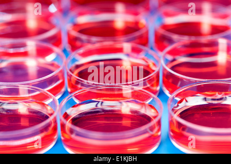 Piastre di Petri utilizzata per il test del sangue. Foto Stock