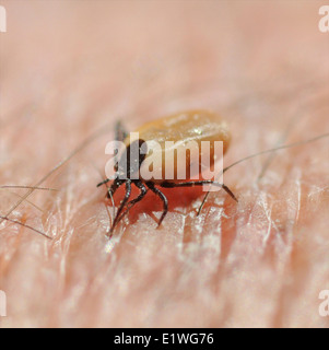 Deer cane Pecore tick sulla pelle umana taglio a succhiare il sangue. Fotografo della propria mano - nessun modello di richiesta di release Foto Stock