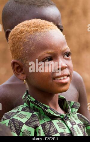 Il Burkina Faso, area Senoufo, villaggio di Negueni, poco ragazza di Albino Foto Stock