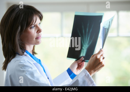 Medico guardando xray immagine della mano Foto Stock