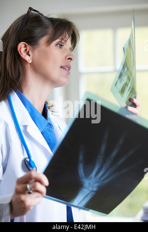 Medico guardando xray immagine della mano Foto Stock