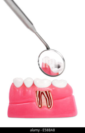 Anatomica del dente Foto Stock