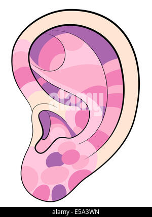 Riflessologia auricolare illustrazione con diversi colori rosa riguardanti i corrispondenti organi interni e le parti del corpo. Foto Stock