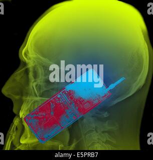 Colorato X-ray che mostra la testa di un uomo con un telefono cellulare. L'uso del telefono cellulare genera microonde che penetrano in Foto Stock