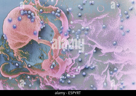 Color scanning electron microfotografia del virus HIV (puntini blu) germogliando da un linfocita T globuli bianchi (giallo e verde). Foto Stock